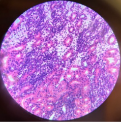 <p>What type of Tissue?</p>