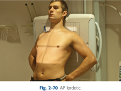 <p>Patient is upright and leaning backwards into the IR</p>