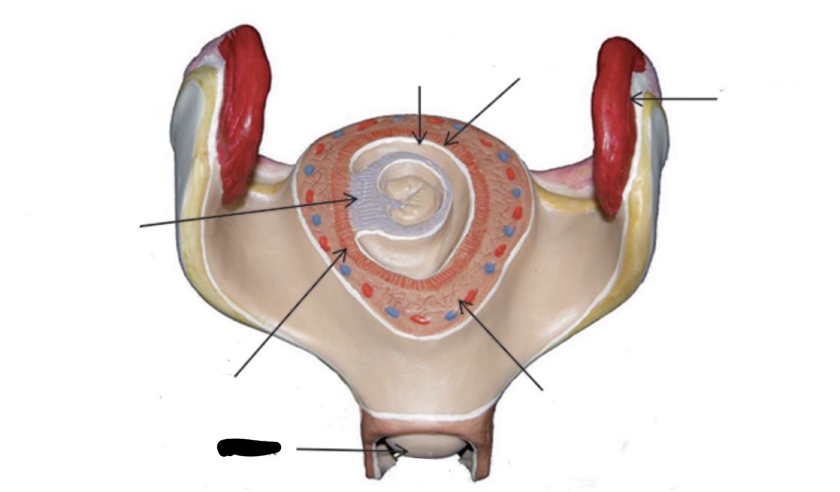 term image