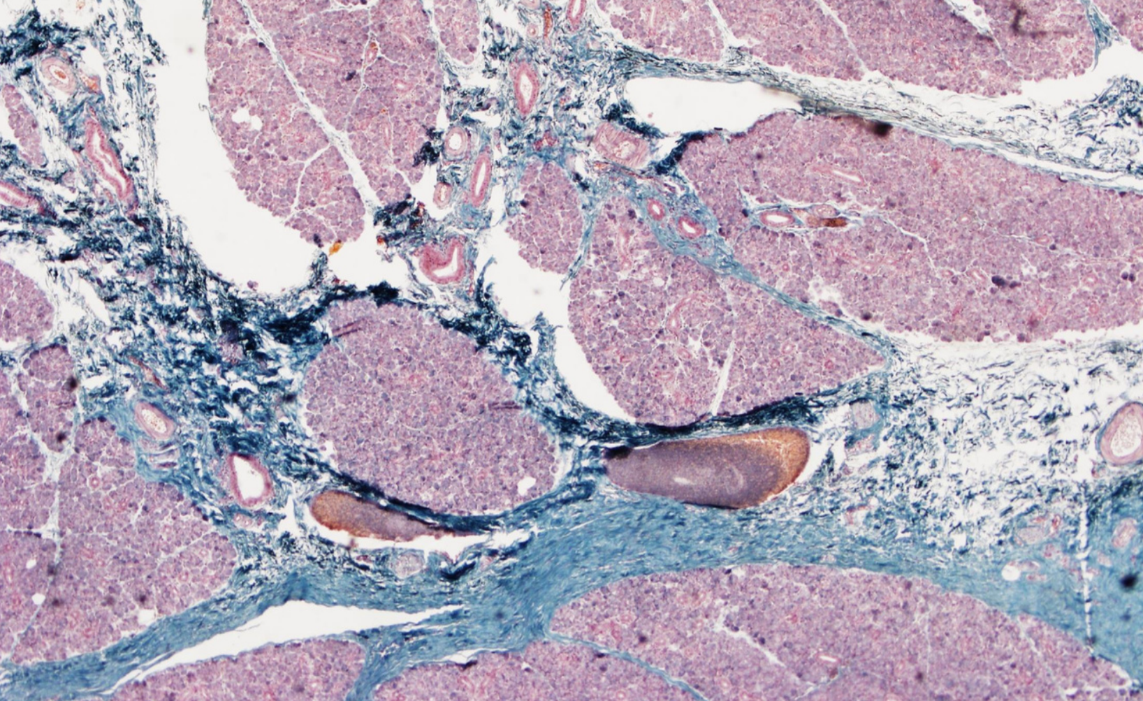 <p>Tiêu bản gì ?</p>