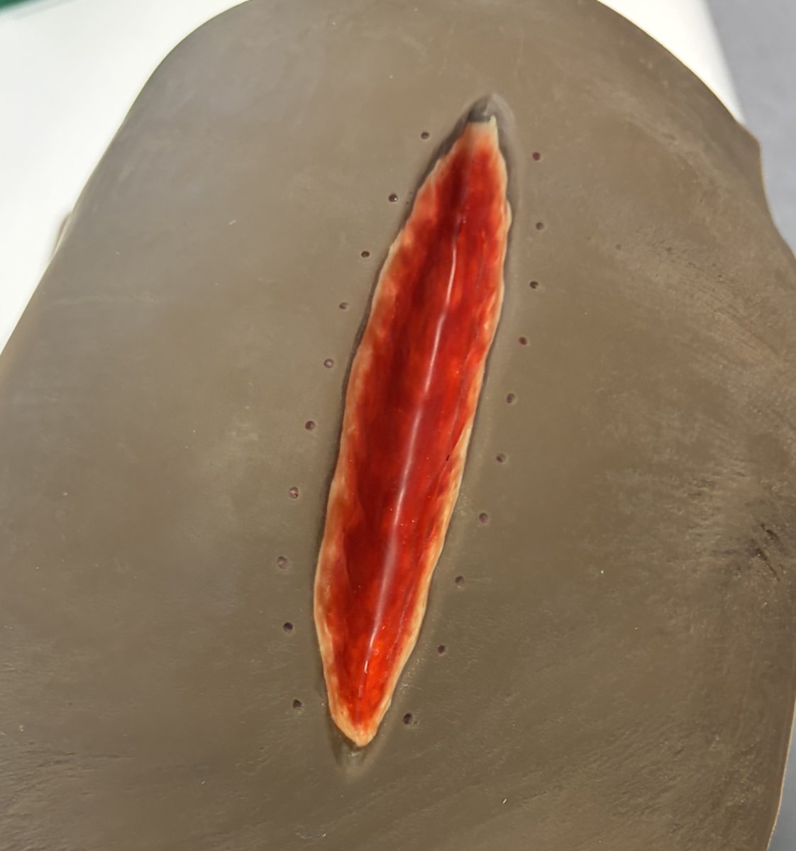 <p>what would you do with this wound.</p>