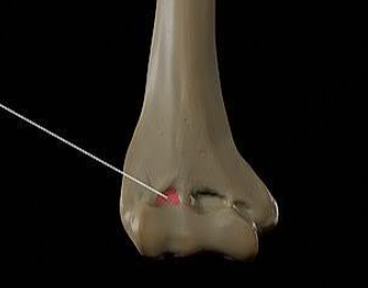 <p>Which bone is this?</p>