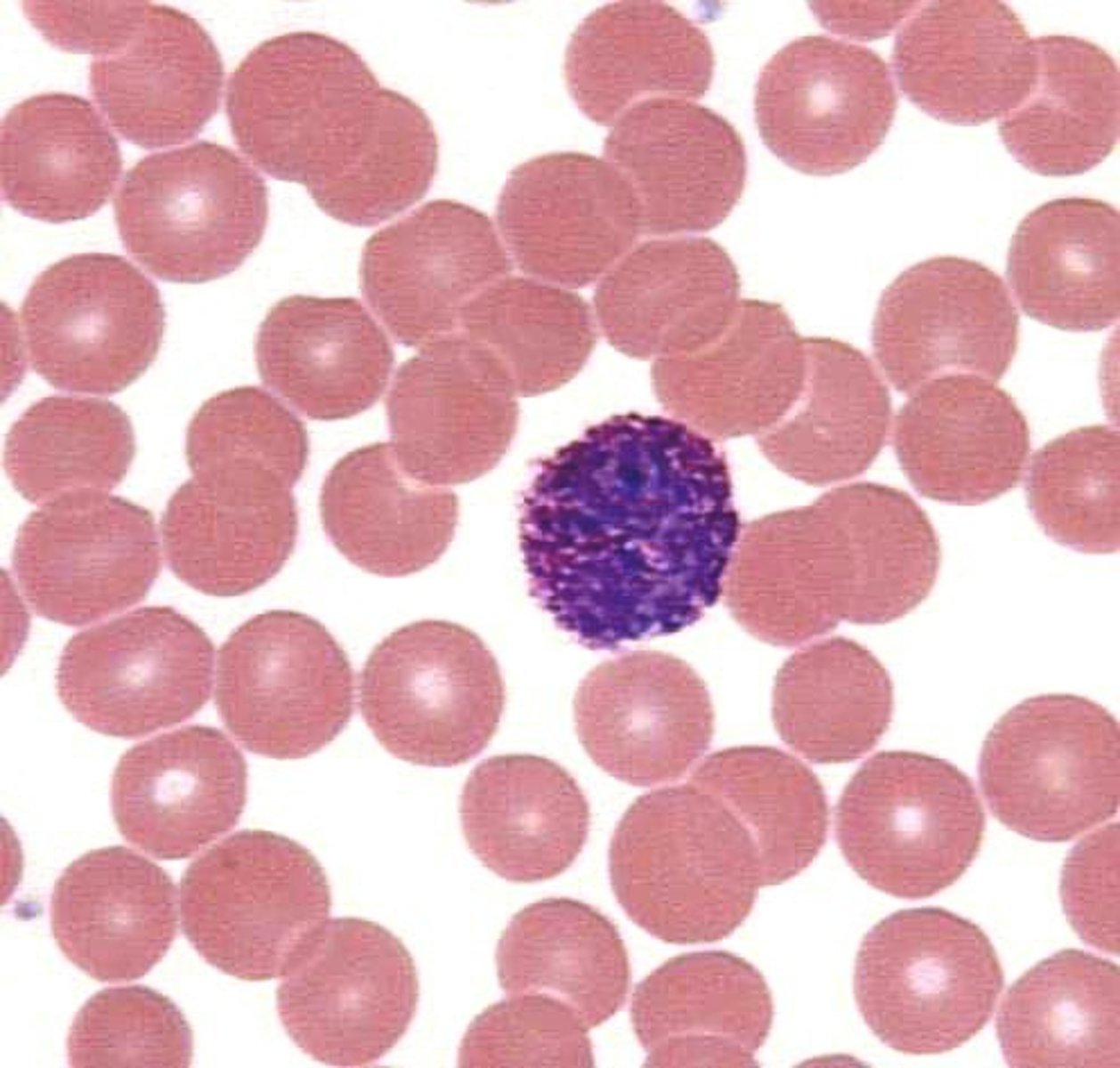 <p>basophil</p>