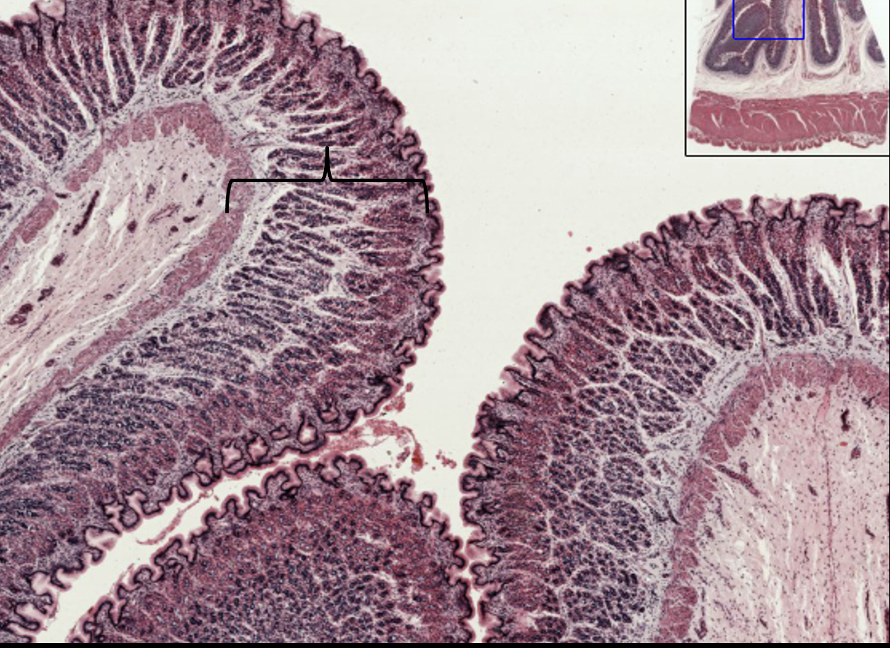 <p>What layer is this?</p>