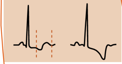 <p>What does this depict?</p>