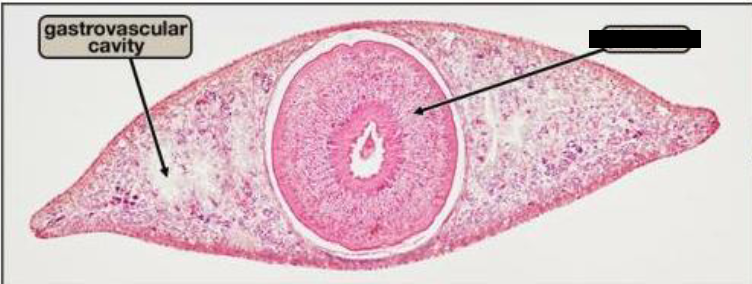 <p>What is this the blank portion? </p>