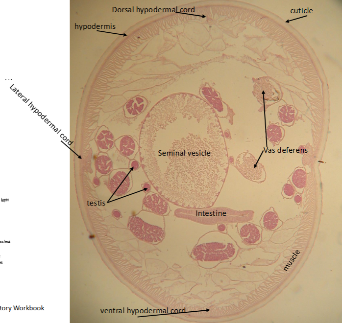 <p>What is the kingdom, phylum, order, and family of this parasite</p>