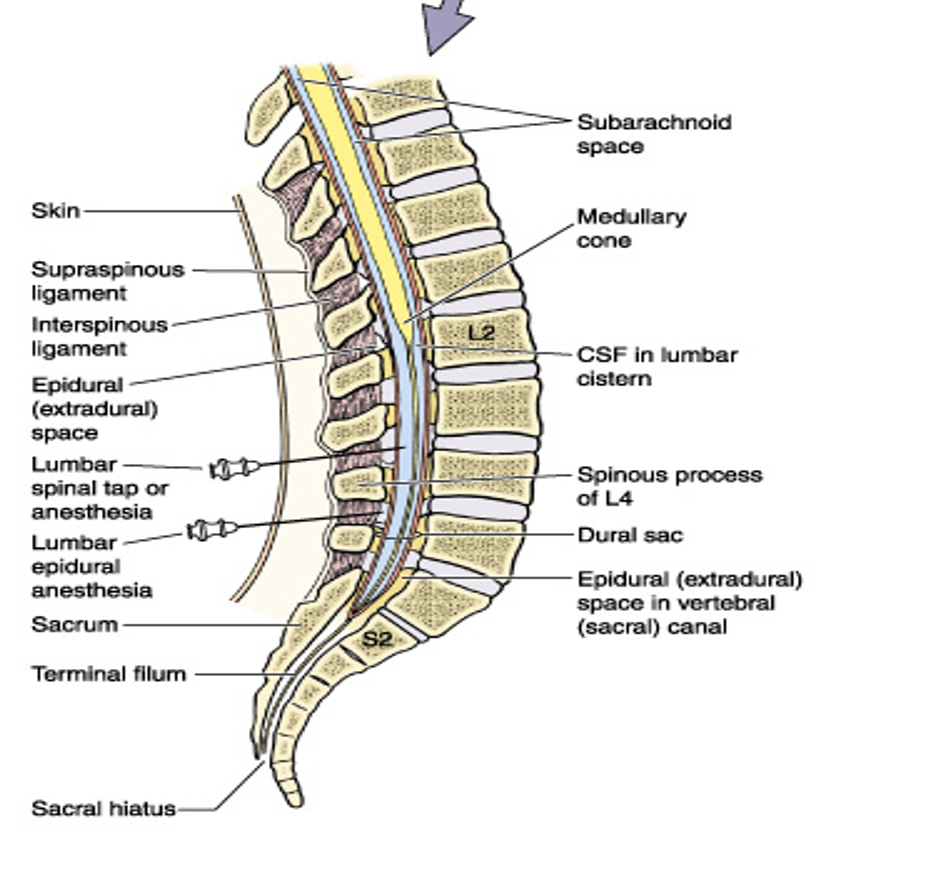 <p>inject into epidural space</p><ul><li><p>doesn’t go into SC or CSF</p></li><li><p>can target a region</p></li><li><p>common during childbirth as they can target L3/L4 level (anesthesia for uterus and cervix) but doesn’t affect lower limbs as much</p></li></ul><p></p>
