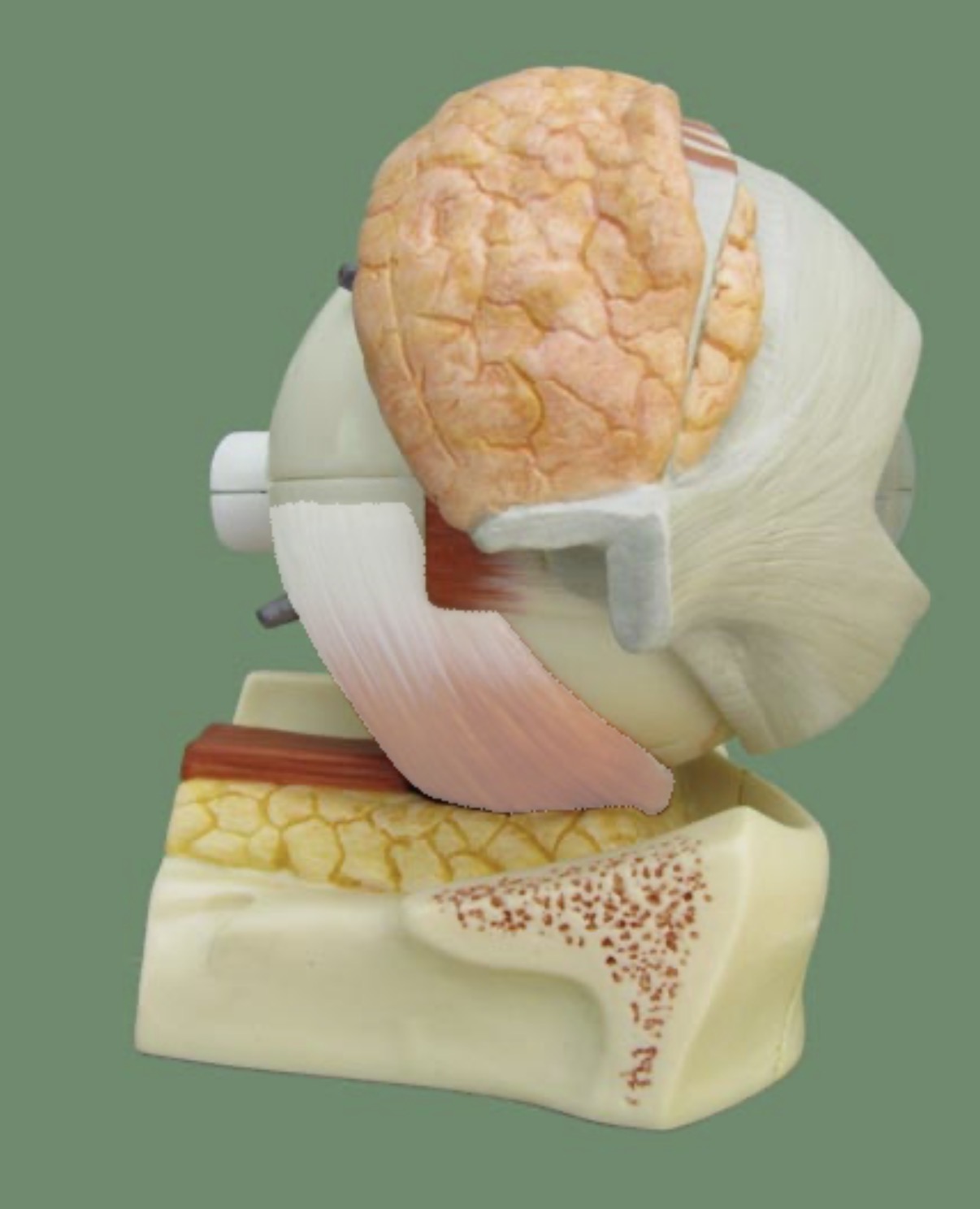 term image