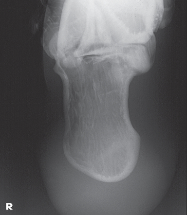 <p>What joints are seen?</p>