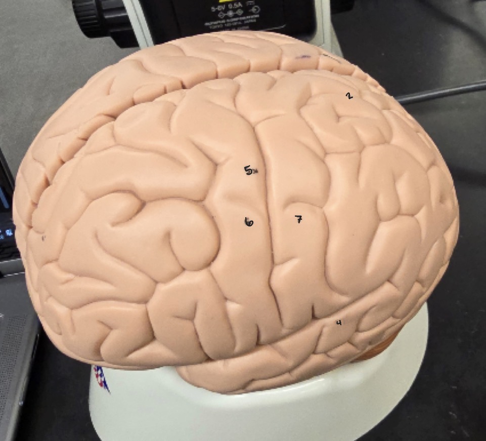 <p>Name Region/Part of Brain, Be Specific (#4)</p>