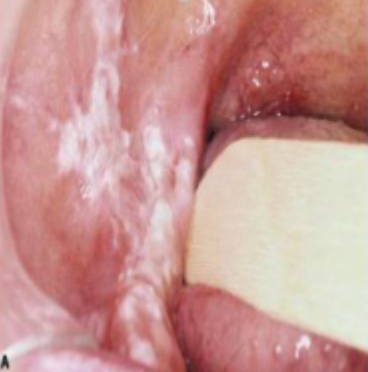 <p>what is this condition</p>
