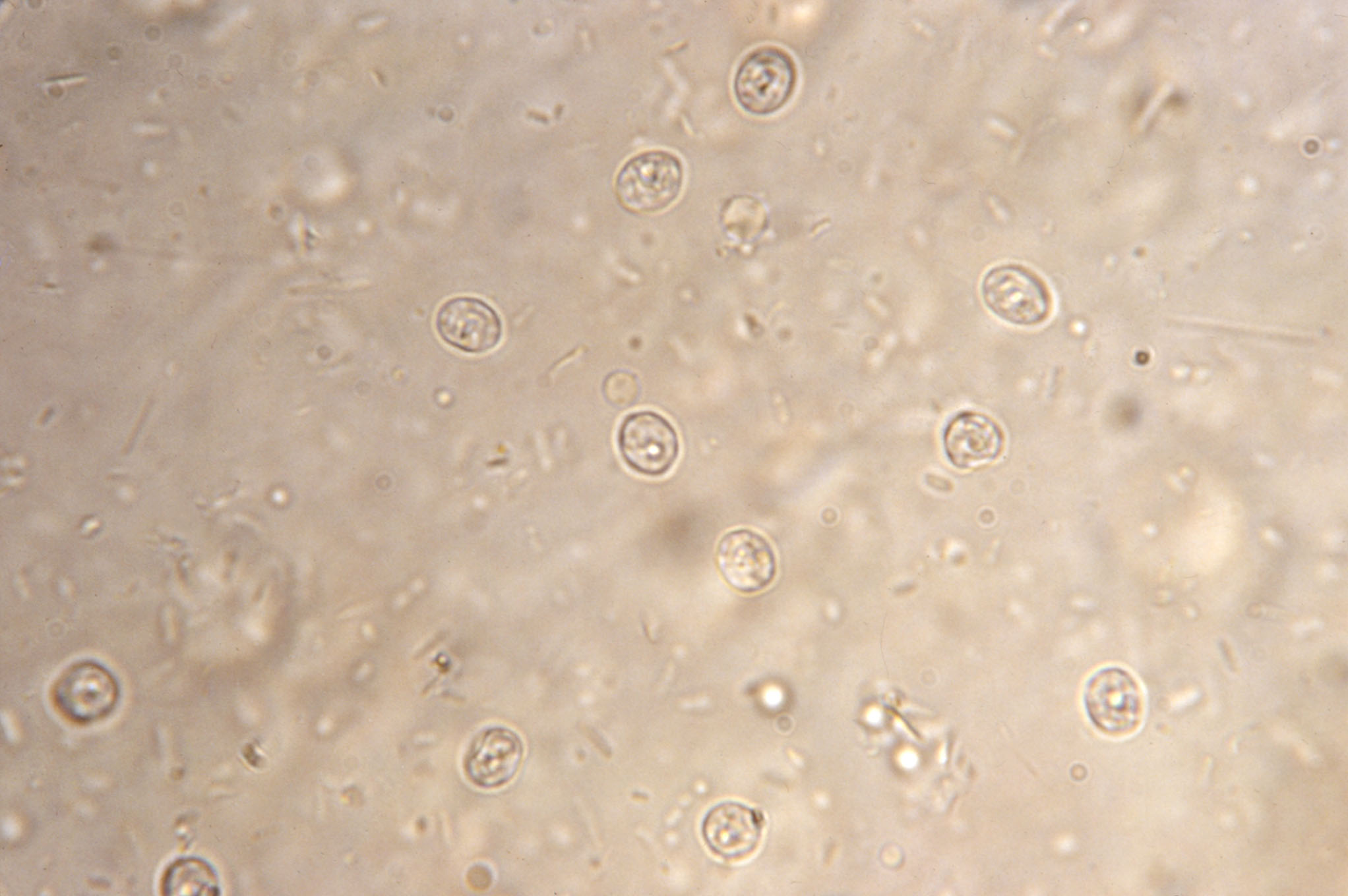 <p>cryptosporidium</p>