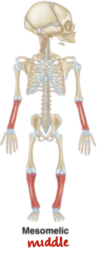 <p>shortening of <span style="color: yellow;">middle</span> segment (rad/uln and tib/fib)</p>