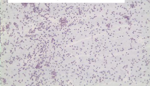 <p>Bacteria Species:</p><p>Endospore +/ - : </p><p></p>