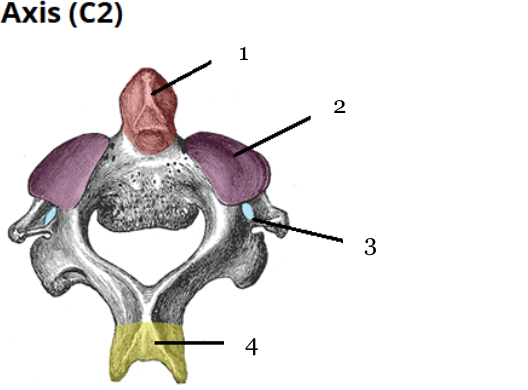 <p>Which number indicates the Bifid spinous process?</p>
