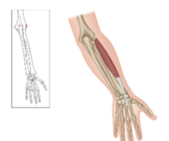 <p>What is the origin for the extensor carpi radialis brevis?</p>