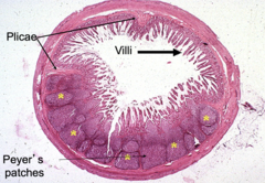 <p>Peyer's patches</p>