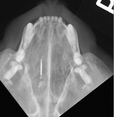 <p>Is this normal or abnormal?</p>