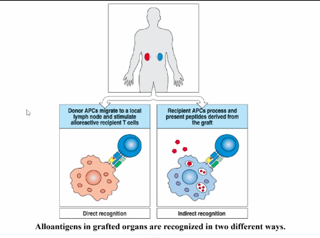 <p>Transplantation</p>