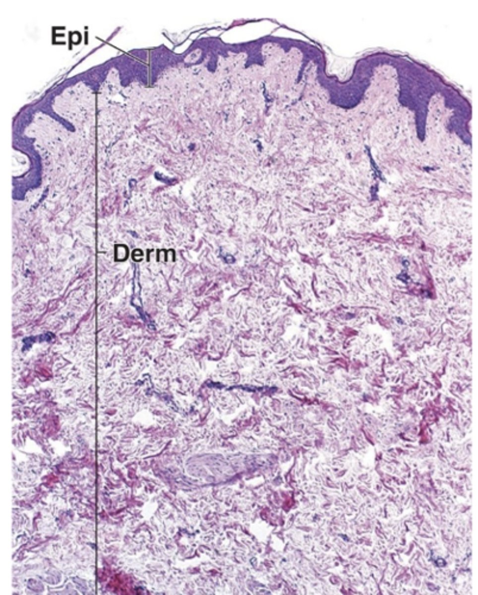<p>Identify the type of skin</p>