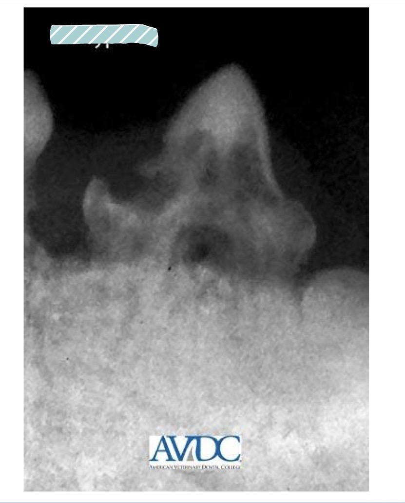 <p>what type of tooth resorption is this?</p>