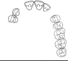 <p>What kennedy classification?</p>