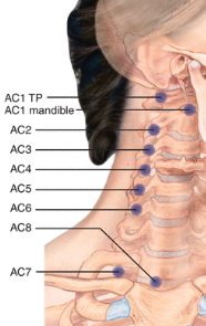 <p>AC7* tender point treatment?</p>
