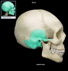 <p>Category: Cranial Bones<br>Features:</p><ul><li><p>squamous suture</p></li><li><p>zygomatic process</p></li><li><p>mandibular fossa</p></li><li><p>external acoustic meatus</p></li><li><p>styloid process</p></li></ul><p></p>