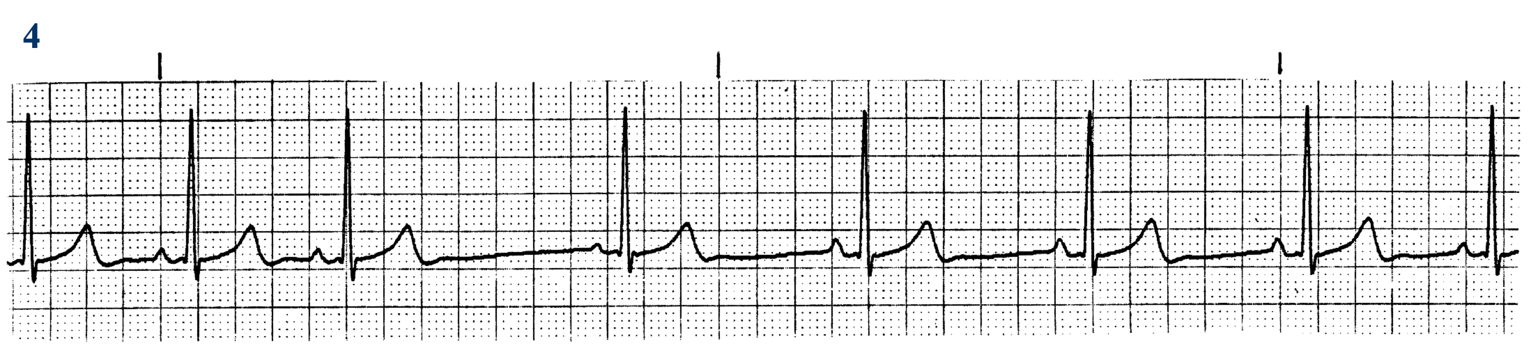 <p>What ECG is this? </p>