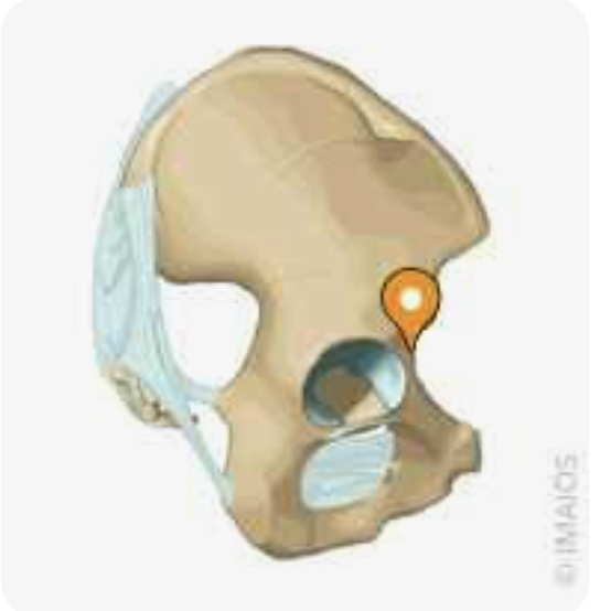 <p>Name this part of the pelvic bone</p>