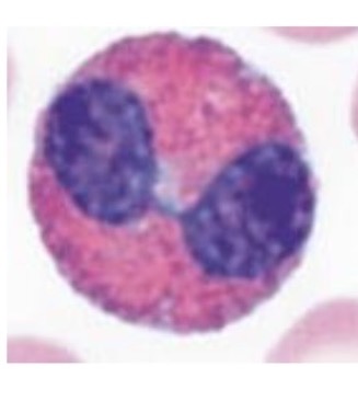 <p>What WBC is this </p>