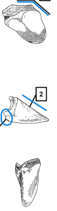 <ul><li><p>hoof</p></li><li><p>straigh slope</p></li><li><p>obtuse angle, leans inwards</p></li><li><p>undercut at posterior</p></li></ul><p></p><p>pig distal phalanx</p><p></p>