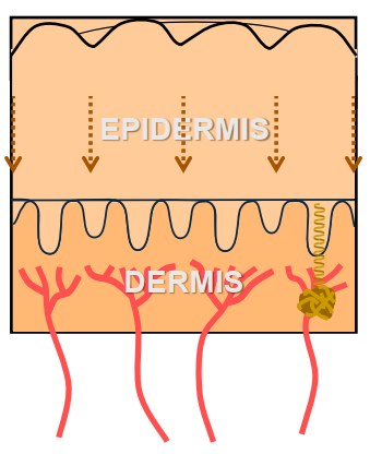 <p>Secondary Ridge Formation</p><ul><li><p>Second proliferation of cells into the dermis - begins ~17 weeks</p></li><li><p>All primary ridge growth STOPS</p></li><li><p>Secondary ridges appear <u>between</u> the primary ridges &amp; <u>lack eccrine glands</u></p></li><li><p>As the secondary ridges penetrate into the dermis they pull the already tight skin down with them which forms the surface furrows</p></li><li><p>Surface ridges spread across the finger &amp; converge at the delta areas</p></li></ul><p></p>
