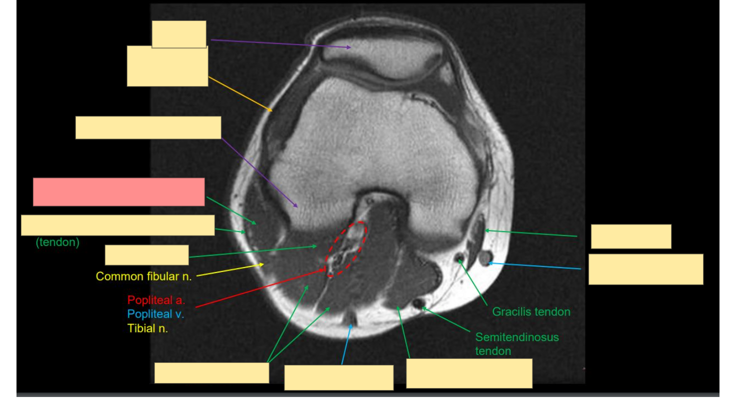 <p>Identify this structure</p>