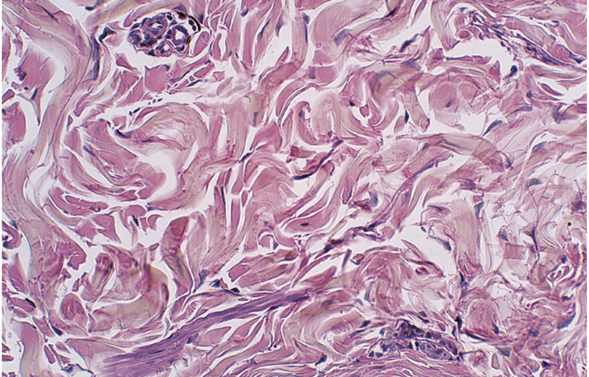 <p>What kind of dense connective tissue is pictured</p>
