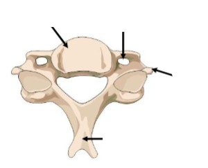 <p>What type of vertebrae is this</p>
