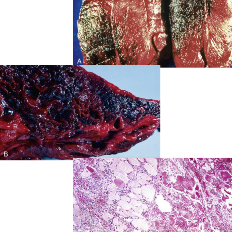 <p>Image of skeletal muscle from a cow with histo slides. What likely caused these lesions?</p>