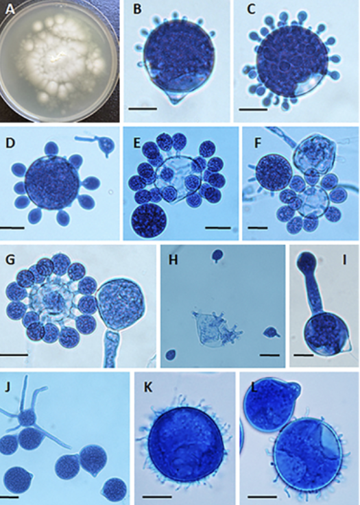 <p><strong>hyphae (stolon): </strong>broad, few septa (inc w age)</p><p><strong>sprangophores: </strong>unbranched, bear single spores</p><p><strong>sproangia:</strong> can produce hair-like appendages called villae or protuberances called papillae </p>