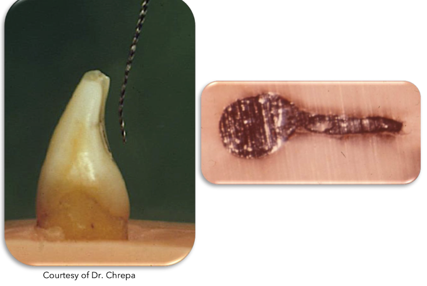 <p>what to use for instrumentation of fin </p>
