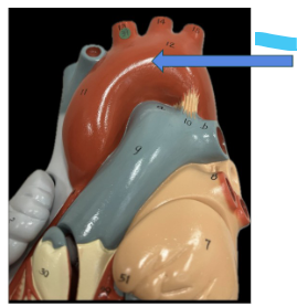<p>What is the blue arrow?</p>