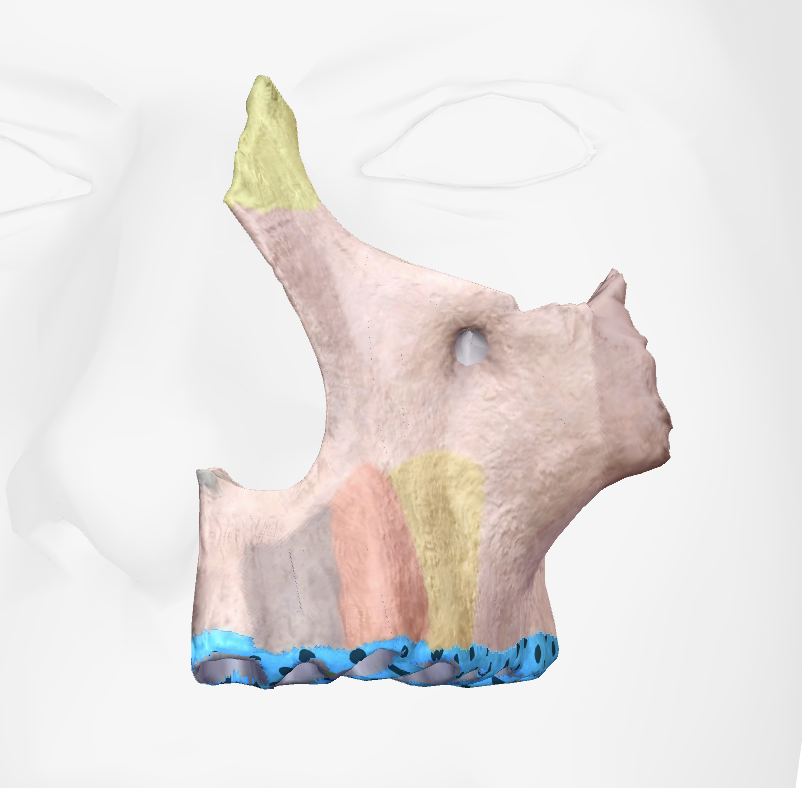 term image