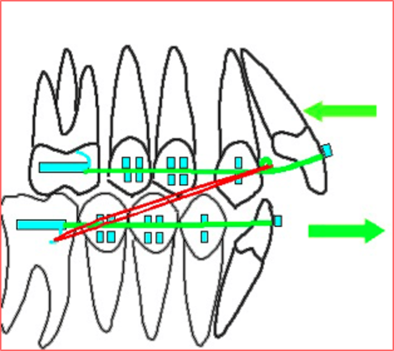 <p>ID the elastics class:</p>