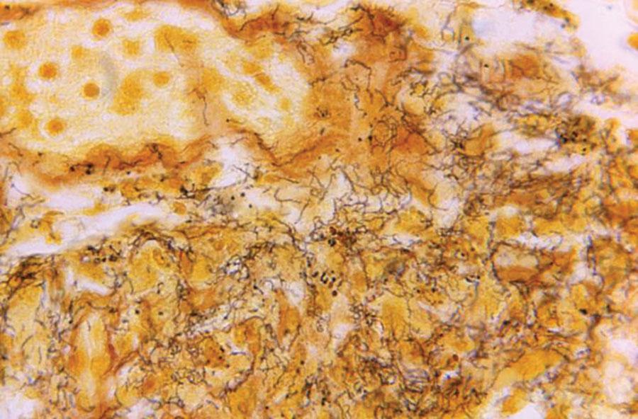 <p><em>Van Orden, S. (1966). Treponema pallidum spirochetes in tissue stained with Steiner silver stain [Photomicrograph]. Centers for Disease Control and Prevention.</em></p>