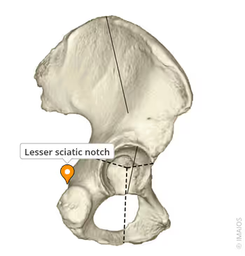<p>What landmark within <strong>Ischium</strong></p>