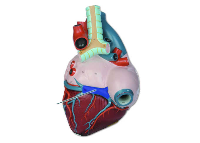 <p><span>Identify the highlighted vessel.</span></p>