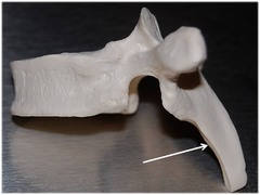 <p>Name this specific part of the thoracic vertebra.</p>