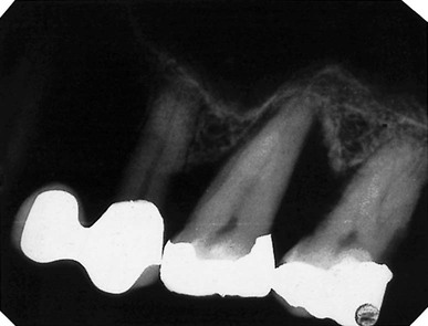 <p>What exposure error may have caused this result:</p>