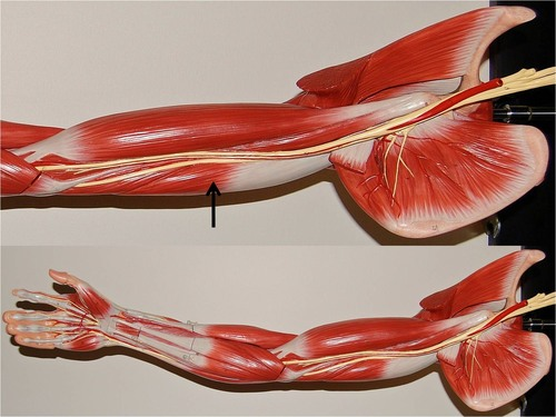<p>What muscle is this?</p>