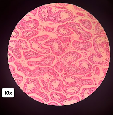 <p>This slide depicts which endocrine gland</p>